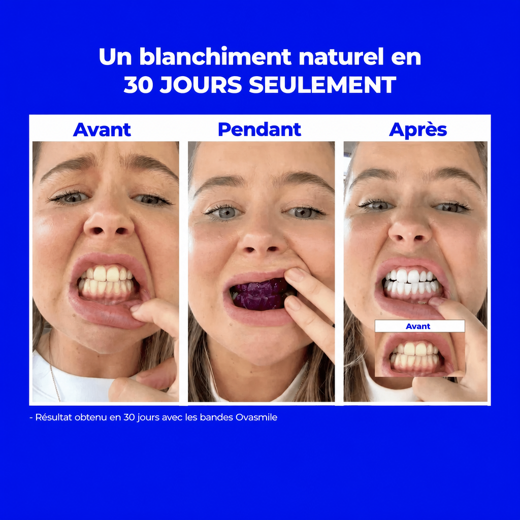 BANDES BLANCHISSANTES V12